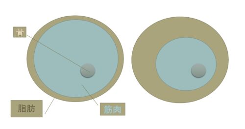 %e3%82%b5%e3%83%ab%e3%82%b3%e3%83%9a%e3%83%8b%e3%82%a2%e8%82%a5%e6%ba%80